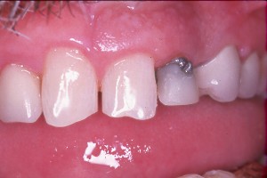 cosmetic dentist post